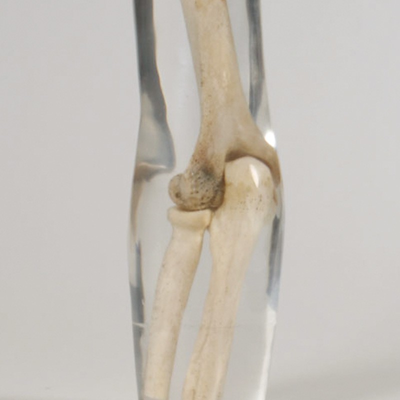 XRay Arm Phantom Test Phantoms QUART XRay QA QC Solutions